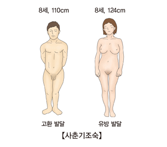 사춘기 조숙