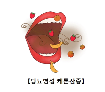 당뇨병성 케톤산증