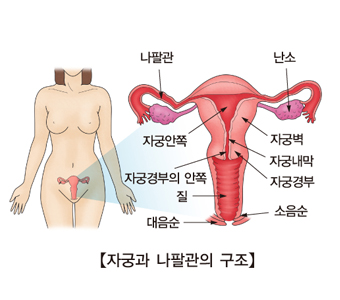 자궁경부염