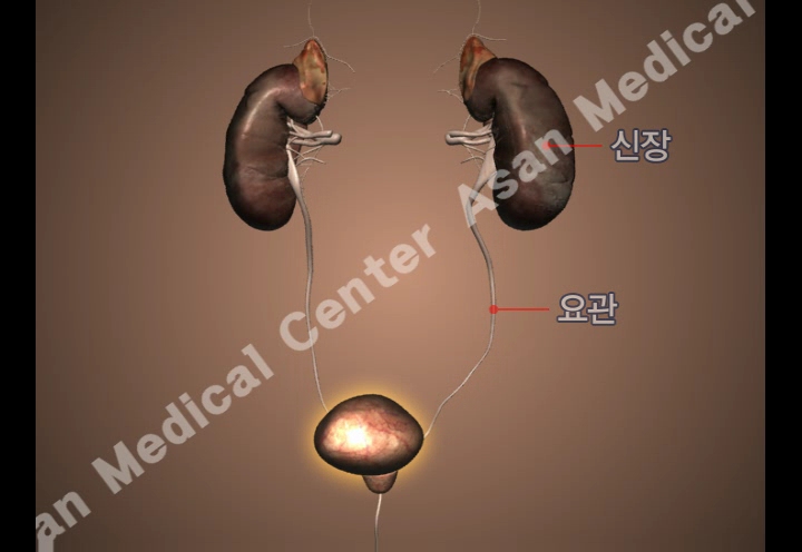 급성 방광염