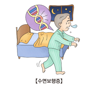 수면보행증