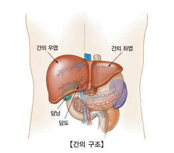 간경화