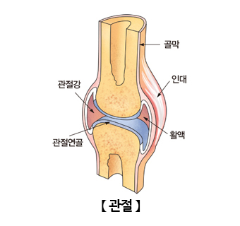 관절