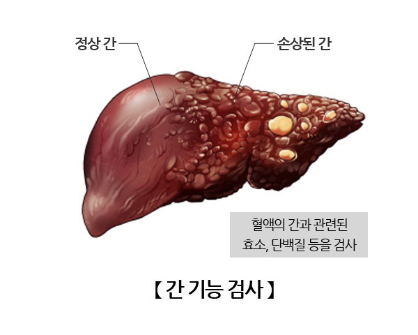 간기능 검사