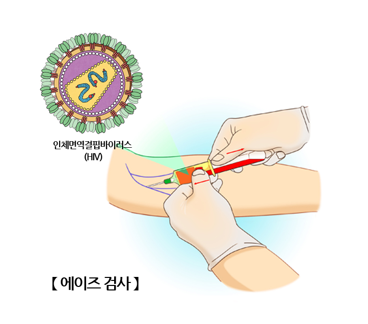 에이즈 검사