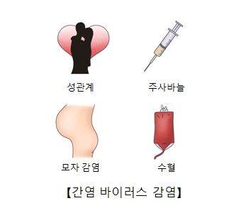 C 형간염