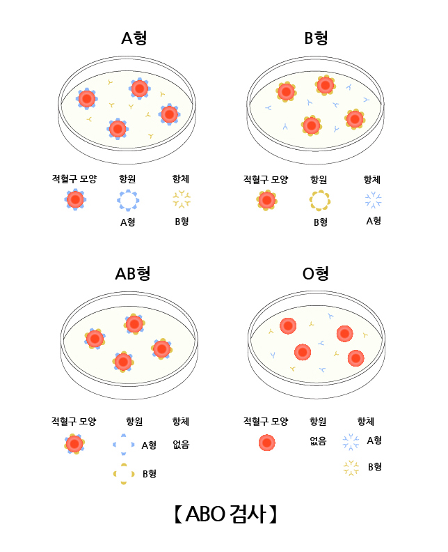 혈액형검사