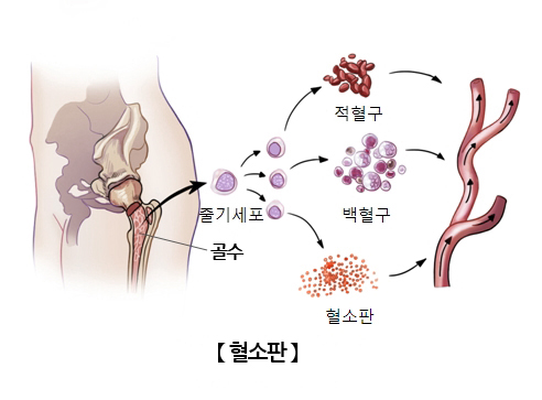 혈소판