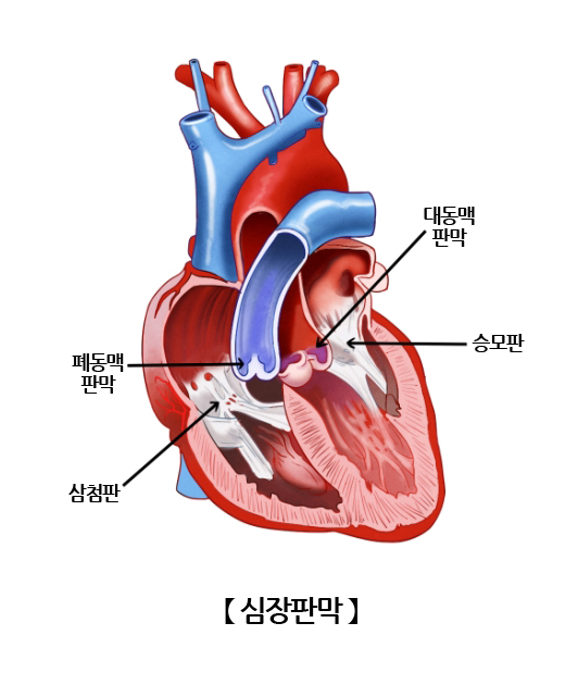 심장판막