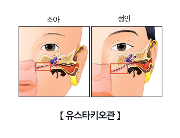 유스타키오관